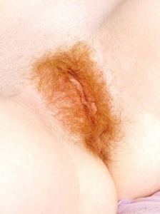 Hairy Redhead